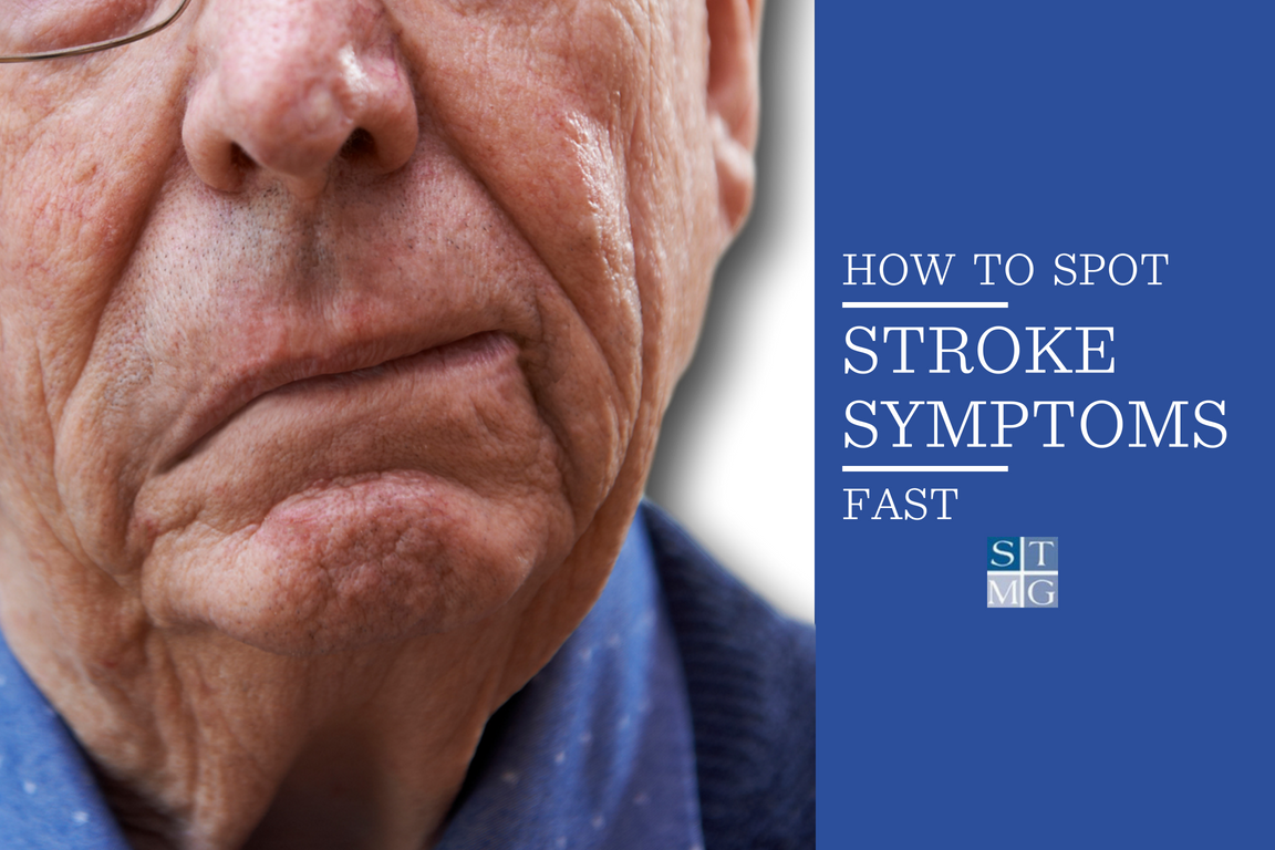 Spot Stroke Symptoms FAST With These Guidelines STMG Nashville